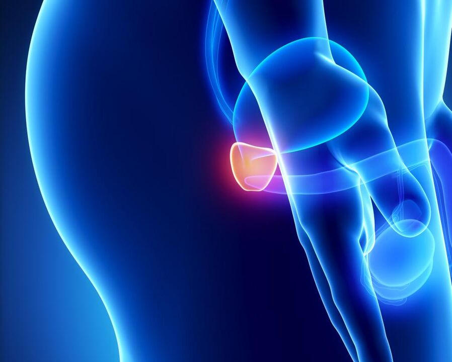 Prostate inflammation